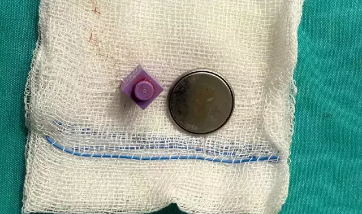 15 Aylık Bebek, Yutulan Düğme Pil ve Lego Parçasıyla Hayatta Kaldı