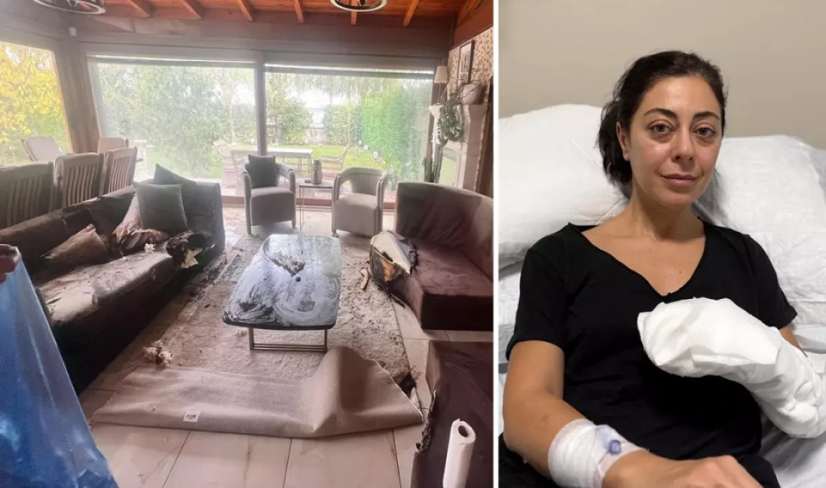 Dekoratif Şömine Bomba Gibi Patladı — Vücudunun Yüzde 30’u Yandı