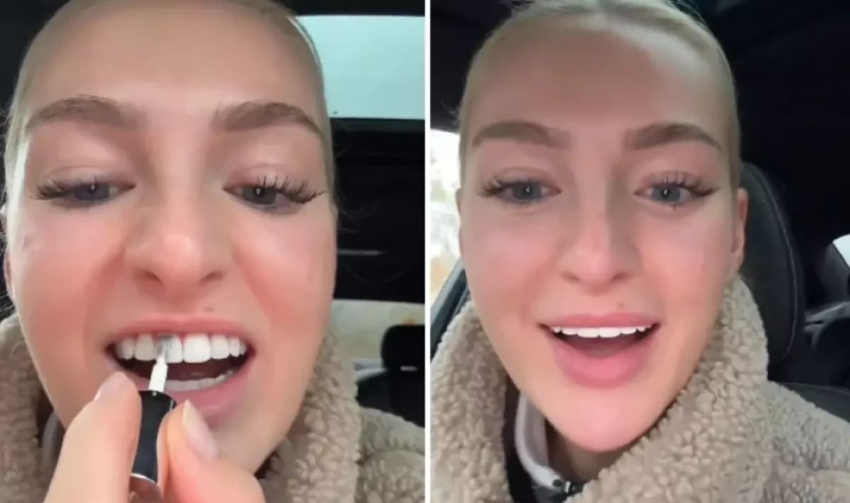 Dişlerini Beyazlatmak İçin Yaptığı “Akılalmaz” Uygulama