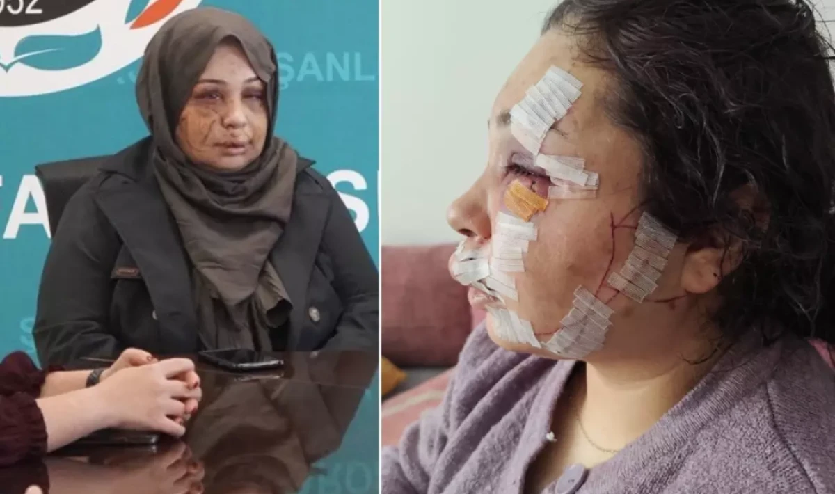 Eşine şiddet uygulayan Cumhurbaşkanı Koruma Dairesi personeli tutuklandı