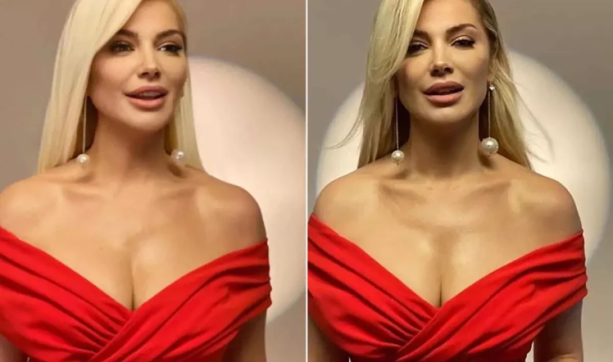 Estetik İddiaları Bitmiyor: Songül Karlı’nın Son Hali