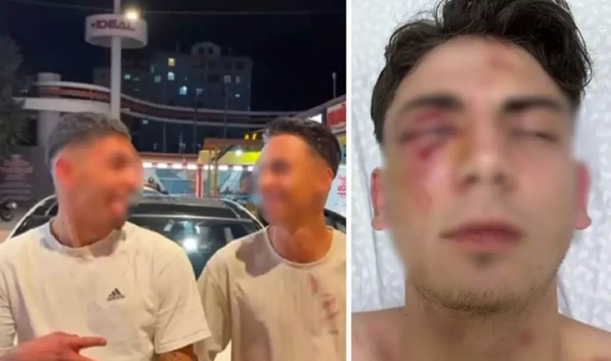 Muştalarla dövülerek kör edilen gençle ilgili yeni gelişme