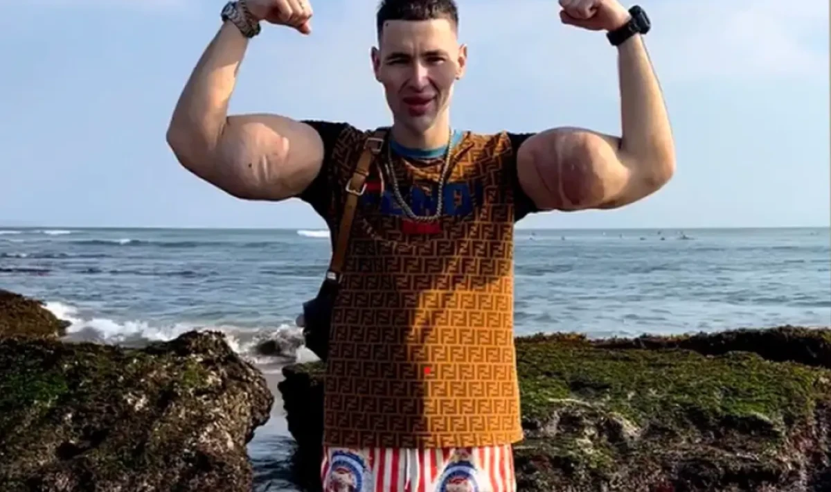 Rus Temel Reis’in Kolları Tehlike Altında İddiası: Kritik Siyasi ve Stratejik Mesajlar