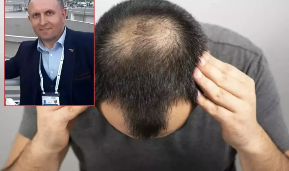 Saç Ekimi İçin Gittiği Klinik Sonu Oldu: Trabzon’da 47 Yaşındaki Temel Altuntaş Hayatını Kaybetti